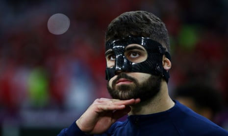 Why Do Some Soccer Players Wear Masks